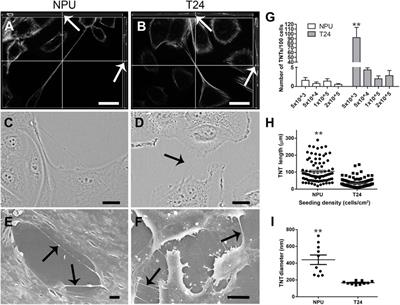 Molecular, morphological and functional properties of tunnelling nanotubes between normal and cancer urothelial cells: New insights from the in vitro model mimicking the situation after surgical removal of the urothelial tumor